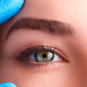 Blefaroplasma